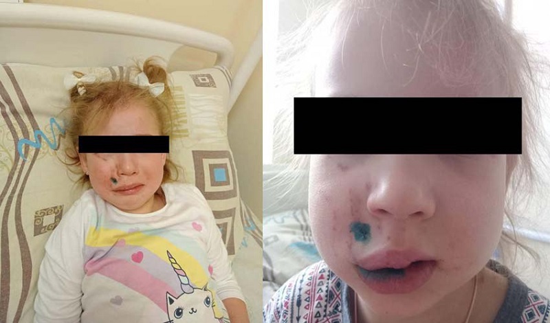 ЧП около брянского кафе «Итальянцы» вышло на федеральный уровень — на контроль главы СК РФ
